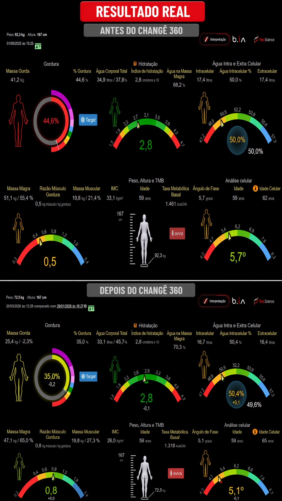 Resultado real de paciente — antes e depois do Changê 360